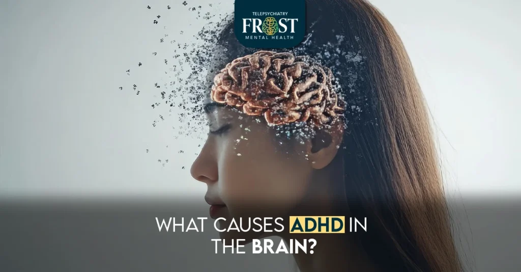 What Causes ADHD in the Brain